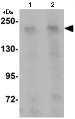 Lane 1 : Anti-Girdin antibody (ab113890) at 1 µg/mlLane 2 : Anti-Girdin antibody (ab113890) at 2 µg/mlLane 1 : Rat brain lysateLane 2 : Rat brain lysate