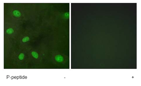 Immunofluorescence analysis of HeLa cells, using ab61077 at 1/500 dilution with or without phospho peptide.
