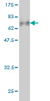Western blot against tagged recombinant protein immunogen using ab56557 GIT2 antibody at 1ug/ml.