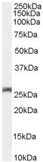 Anti-GJB2 antibody (ab59020) at 0.01 µg/ml + Mouse Brain lysate (35µg protein in RIPA buffer)