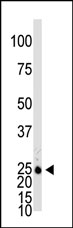 Anti-GJB2 antibody (ab38584) at 1/100 dilution + Mouse brain tissue lysate