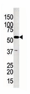 Anti-GK2 antibody - C-terminal (ab71529) at 1/100 dilution + Jurkat cell lysate at 12.5 µg