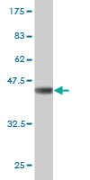 Western blot against tagged recombinant protein immunogen using ab55437 Gli3 antibody at 1ug/ml.