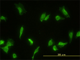 GLMN antibody (ab56775) used in immunofluorescence at 20ug/ml on HeLa cells.