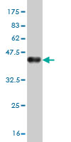 Western blot against tagged recombinant protein immunogen using ab56563 GLP2R antibody at 1ug/ml.