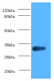 Anti-glsA1 antibody (ab193526) at 2 µg/ml + DH5a whole cell lysateSecondaryGoat polyclonal to Rabbit IgG at 1/10000 dilution