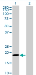 All lanes : Anti-GLT28D1 antibody (ab69070) at 1/500 dilutionLane 1 : GLT28D1 transfected 293T cell lysateLane 2 : Non-transfected 293T cell lysateLysates/proteins at 25 µg per lane.SecondaryGoat anti-mouse IgG (H&L)-HRP conjugated at 1/2500 dilution