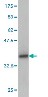 Western blot against tagged recombinant protein immunogen using ab57173 GLTSCR2 antibody at 1ug/ml.