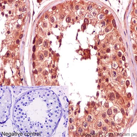 Immunohistochemical analysis of paraffin-embedded Human testis tissue labeling CRNKL1 with ab192248 at 1/600 dilution (1μg/ml), followed by prediluted HRP Polymer for Rabbit/Mouse IgG. Counter stained with Hematoxylin.