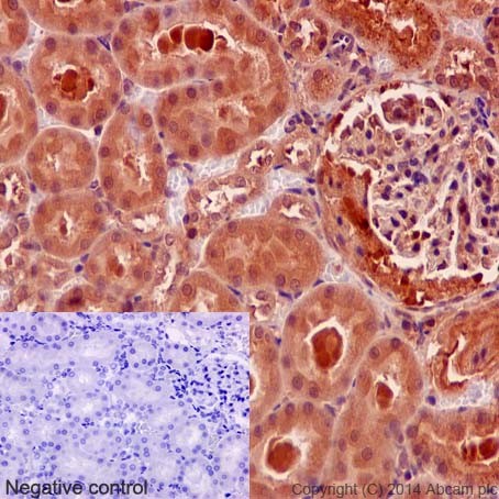 Immunohistochemical analysis of paraffin-embedded Rat kidney tissue labeling CRNKL1 with ab192248 at 1/600 dilution (1μg/ml), followed by prediluted HRP Polymer for Rabbit/Mouse IgG. Counter stained with Hematoxylin.