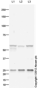 All lanes : Anti-Glucagon Receptor antibody (ab109279) at 1/250 dilution (Milk Blocking - 3%)Lane 1 : Caco 2 (Human colonic carcinoma cell line) Whole Cell LysateLane 2 : HepG2 (Human hepatocellular liver carcinoma cell line) Whole Cell LysateLane 3 : SW480 (Human colon adenocarcinoma cell line) Whole Cell LysateLysates/proteins at 20 µg per lane.SecondaryGoat Anti-Rabbit IgG H&L (HRP) preadsorbed (ab97080) at 1/5000 dilutiondeveloped using the ECL techniquePerformed under reducing conditions.
