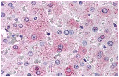 Immunohistochemical analysis of formalin-fixed, paraffin-embedded Human liver tissue labelling Glucagon Receptor with ab150581 at 6 µg/ml.