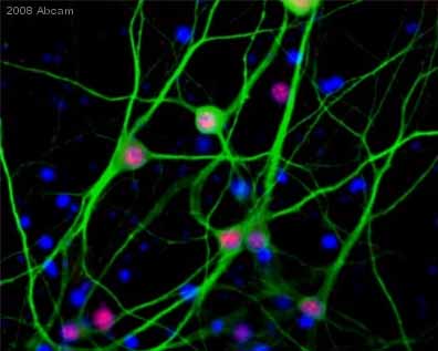 ab9568 staining human primary neuron cells by ICC/IF.  Cells were PFA fixed and permeabilized in 0.2% Triton X 100 in PBST (0.1%Tween) for 30 mins at RT prior to blocking with 10% normal donkey serum for 2 hrs at 21°C.  The primary antibody was used at a concentration of 5 µg/ml and incubated with the sample for 18 hrs at 4°C.  An Alexa Fluor® 546 conjugated donkey anti-mouse antibody was used as the secondary.Cells were counterstained with MAP2 and Neurofilament -- Green, and Hoecht's - Blue.  Image is 40X, 3D deconvolved 10 planes at 5um steps.See Abreview