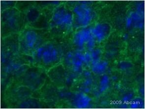 ab652 staining Glucose Transporter GLUT1 in mouse liver tissue section by Immunohistochemistry (Frozen sections). Tissue samples were fixed with formaldehyde and permeabilized with 0.2% Triton X-100 before blocking with 2% BSA was performed for 30 minutes at 200C. The sample was incubated with primary antibody (1/200) for 9 hours at 40C. An Alexa Fluor®488-conjugated Goat polyclonal to rabbit IgG was used as secondary antibody at dilution at 1/200. DAPI was used to stain the cell nuclei (blue).See Abreview