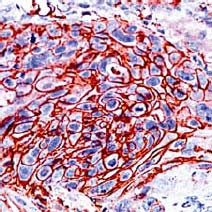 ab15309 staining Glucose Transporter GLUT1 in human esophagous by Immunohistochemistry (FFPE-sections).