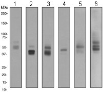 All lanes : Anti-Glucose Transporter GLUT1 antibody [EPR3915] (ab115730) at 1/1000 dilutionLane 1 : Jurkat lysateLane 2 : Mouse brain lysateLane 3 : Human fetal brain lysateLane 4 : 3T3L1 lysateLane 5 : Human fetal liver lysateLane 6 : HepG2 lysateLysates/proteins at 10 µg per lane.