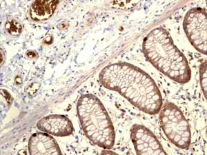 ab115730 showing positive staining in Normal colon tissue.
