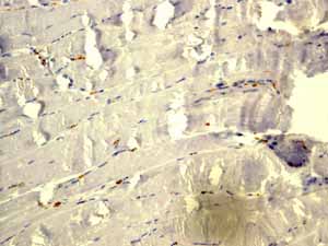 ab115730 showing negative staining in Skeletal muscle tissue.
