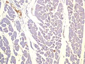 ab115730 showing negative staining in Normal heart tissue.