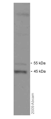 Anti-Glucose Transporter GLUT1 antibody [SPM498] (ab40084) at 1/500 dilution + Whole cell lysate prepared from human MDA-MB 231 cells at 20 µgSecondaryHRP conjugated sheep polyclonal to mouse IgG at 1/5000 dilutiondeveloped using the ECL technique