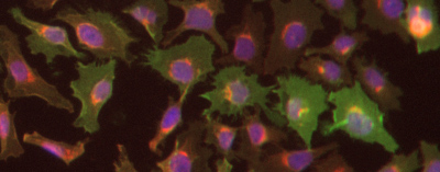 ICC/IF image of ab40084 stained HeLa cells. The cells were 4% PFA fixed (10 min) and then incubated in 1%BSA / 10% normal goat serum / 0.3M glycine in 0.1% PBS-Tween for 1h to permeabilise the cells and block non-specific protein-protein interactions. The cells were then incubated with the antibody (ab40084, 1µg/ml) overnight at +4°C. The secondary antibody (green) was Alexa Fluor® 488 goat anti-mouse IgG (H+L) used at a 1/1000 dilution for 1h. Alexa Fluor® 594 WGA was used to label plasma membranes (red) at a 1/200 dilution for 1h. DAPI was used to stain the cell nuclei (blue) at a concentration of 1.43µM.