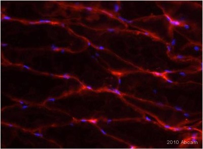 ab40084 staining Glucose Transporter GLUT1 in mouse smooth muscle tissue sections by IHC-Fr (Frozen sections). Tissue samples were fixed with acetone and blocked with 5% serum for 2 hours at 25°C. The sample was incubated with primary antibody (1/200 im PBS-Tween) at 25°C for 1 hour. An Alexa Fluor®594-conjugated Goat polyclonal to mouse IgG (1/250) was used as secondary antibody. See Abreview