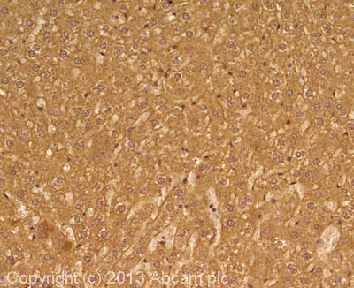 IHC image of Glucose Transporter GLUT2 staining in rat liver formalin fixed paraffin embedded tissue section, performed on a Leica Bond system using the standard protocol F. The section was pre-treated using heat mediated antigen retrieval with sodium citrate buffer (pH6, epitope retrieval solution 1) for 20 mins. The section was then incubated with ab104622, 1/200 dilution, for 15 mins at room temperature and detected using an HRP conjugated compact polymer system. DAB was used as the chromogen. The section was then counterstained with haematoxylin and mounted with DPX.For other IHC staining systems (automated and non-automated) customers should optimize variable parameters such as antigen retrieval conditions, primary antibody concentration and antibody incubation times.