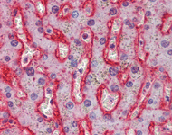 ab111117, at 2.5µg/ml, staining Glucose Transporter GLUT2 in formalin-fixed, paraffin-embedded Human Liver tissue by Immunohistochemistry.