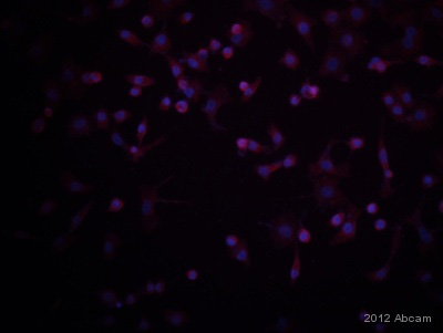 ab111117 staining Glucose Transporter GLUT2 in human MCF7 cells by Immunocytochemistry/ Immunofluorescence.Cells were fixed in paraformaldehyde, blocked with 1% BSA for 30 minutes at 22°C and then incubated with ab111117 at a 1/200 dilution. The secondary used was ab7123, Donkey polyclonal Secondary Antibody to Goat IgG - H&L (TR), pre-adsorbed, used at a 1/200 dilution.See Abreview