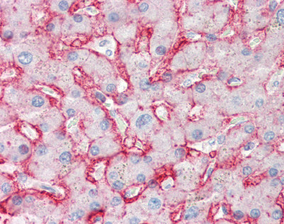 ab85715, at 10 µg/ml, staining Glucose Transporter GLUT2 in formalin-fixed, paraffin-embedded human Liver tissue by Immunohistochemistry.