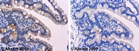 ab41525 staining GLUT3 in human duodenum.Left panel: with primary antibody at 4 ug/ml. Right panel: isotype control.Sections were stained using an automated system (DAKO Autostainer Plus), at room temperature: sections were rehydrated and antigen retrieved with the Dako 3 in 1 AR buffers EDTA pH 9.0. Slides were peroxidase blocked in 3% H2O2 in methanol for 10 mins. They were then blocked with Dako Protein block for 10 minutes (containing casein 0.25% in PBS) then incubated with primary antibody for 20 min and detected with Dako envision flex amplification kit for 30 minutes. Colorimetric detection was completed with Diaminobenzidine for 5 minutes. Slides were counterstained with Haematoxylin and coverslipped under DePeX. Please note that for manual staining we recommend to optimize the primary antibody concentration and incubation time (overnight incubation), and amplification may be required.