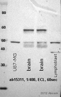 All lanes : Anti-Glucose Transporter GLUT3 antibody (ab15311) at 1/400 dilutionLane 1 : Lysate prepared from U87-MG cellsLane 2 : Lysate prepared from human brainLane 3 : Lysate prepared from human brainLane 4 : Lysate prepared from lymphoblastoid cell lineLysates/proteins at 15 µg per lane.SecondaryGoat anti-rabbit IgG-HRP at 1/7500 dilution