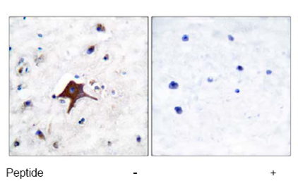 Human brain tissue labelled with ab53095 at a 1/50 dilution, either incubated with (right image) or without (left image) the peptide.