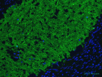 ab654 at a 1/300 dilution, staining human GLUT4 in fetal heart tissue by Immunohistochemistry, frozen tissue.See Abreview
