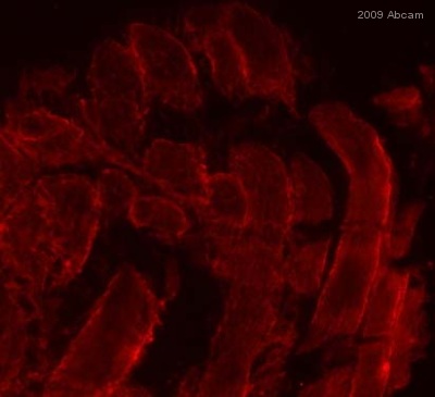 ab654 at 1/500 dilution staining GLUT4 in mouse muscle by immunohistochemistry (frozen sections). Sections were methanol fixed prior to blocking in 5% goat serum for 1 hour at 25°C and then incubated with ab654 for 1 hour at 25°C. A goat polyclonal to rabbit Ig, diluted 1/500, was used as the secondary antibody.See Abreview