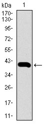Anti-Glucose Transporter GLUT4 antibody [3G10A3] (ab166704) at 1/500 dilution + Glucose Transporter GLUT4 Human recombinant protein