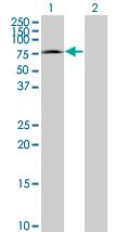 All lanes : Anti-CRSP7 antibody (ab77036) at 5 µg/mlLane 1 : CRSP7 transfected 293T cell lineLane 2 : Non-transfected 293T cell lineLysates/proteins at 25 µg per lane.SecondaryGoat Anti-Mouse IgG (H&L)-HRP Conjugate at 1/2500 dilution