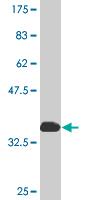 Anti-CRSP7 antibody (ab77036) at 5 µg/ml + Partial recombinant CRSP7 at 0.2 µgSecondaryGoat Anti-Mouse IgG (H&L)-HRP Conjugate at 1/5000 dilution