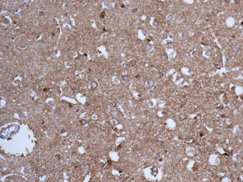 ab166618 showing +ve staining in Human normal brain.