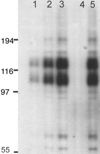 Lane 1 :  Anti-Glutamate Receptor 1 (AMPA subtype) (phospho T840) antibody (ab12108) at 0.3 µg/mlLane 2 :  Anti-Glutamate Receptor 1 (AMPA subtype) (phospho T840) antibody (ab12108) at 1 µg/mlLanes 3 - 5 :  Anti-Glutamate Receptor 1 (AMPA subtype) (phospho T840) antibody (ab12108) at 3 µg/mlLane 1 : mouse brain extractLane 2 : mouse brain extractLane 3 : mouse brain extractLane 4 : mouse brain extract with Mouse Glutamate Receptor 1 (AMPA subtype) (phospho T840) peptide (ab12399) at 2 µg/mlLane 5 : mouse brain extract with Mouse Glutamate Receptor 1 (AMPA subtype) (unmodified ) peptide (ab12434) at 2 µg/mlPerformed under reducing conditions.