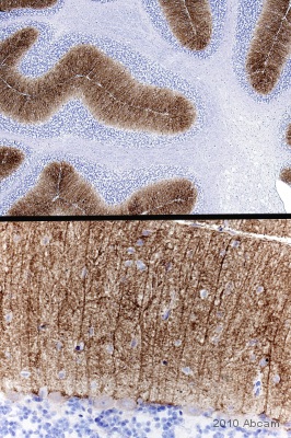 Immunohistochemistical detection of Glutamate Receptor 1 (AMPA subtype)  with ab31232 on formaldehyde-fixed paraffin-embedded rat cerebellum sections. Antigen retrieval step: heat mediated  in citric acid pH6. Blocking step: 1% BSA  for 10 mins @ rt°C.  Primary antibody was incubated at 1/200 for 2 hours @ room temp. Secondary antibody: anti-rabbit IgGs conjugated to biotin (1/200). The composite image shows localisation of this protein apparently exclusive to the molecular layer of the cerebellum upper image (low power). In the lower image (higher power), the molecular layer positivity appears to be compartmentalised/restricted.See Abreview