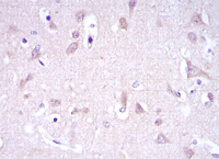 ab130259, at a dilution of 1/200, staining Glutamate receptor 3 in paraffin-embedded Human brain tissue by Immunohistochemistry.