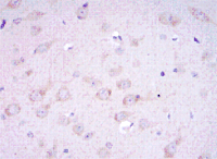 ab130259, at a dilution of 1/200, staining Glutamate receptor 3 in paraffin-embedded Rat brain tissue by Immunohistochemistry.