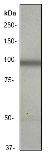 Anti-Glutamate receptor 3 antibody [EP813Y] (ab40845) at 1/5000 dilution + human brain lysate at 10 µg