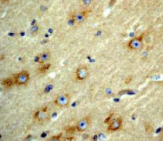 ab40845 at a 1:50 dilution staining Glutamate Receptor 3 in human brain tissue.
