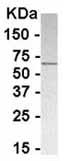 Anti-Glutamyl hydrolase gamma antibody - Azide free (ab37802) at 1/2000 dilution + E. coli derived fusion proteinSecondaryHRP conjugated Goat anti IgY at 1/1000 dilution