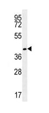 Anti-Glutamyl hydrolase gamma antibody - C-terminal (ab170729) at 1/100 dilution + NCI-H460 cell line lysate at 35 µg