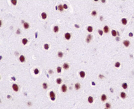 Immunohistochemical analysis of paraffin embedded Mouse brain tissue labeling CRSP9 with ab187146 at 1/100 with prediluted (Ready to use) HRP Polymer for Rabbit IgG as secondary antibody.