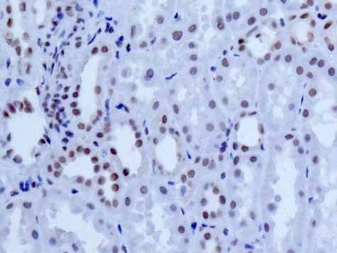ab167401 showing +ve staining in Human normal kidney.