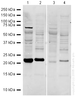 All lanes : Anti-Glutathione Peroxidase 1 antibody (ab22604) at 1 µg/mlLane 1 : Human liver normal tissue lysateLane 2 : Liver (Mouse) Tissue Lysate (ab7935)Lane 3 : Human liver normal tissue lysate with Human Glutathione Peroxidase 1 peptide (ab25301) at 1 µg/mlLane 4 : Liver (Mouse) Tissue Lysate (ab7935) with Human Glutathione Peroxidase 1 peptide (ab25301) at 1 µg/mlLysates/proteins at 20 µg per lane.SecondaryGoat polyclonal to Rabbit IgG at 1/10000 dilutionPerformed under reducing conditions.